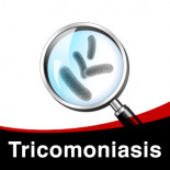 Tratamento da Tricomoniasis nos Pássaros